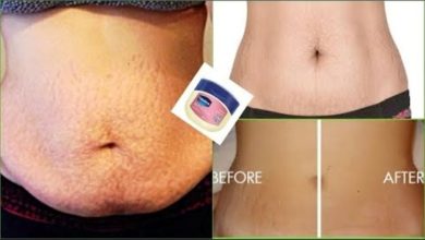 How to Use Vaseline and The Cream for Stretch Mark